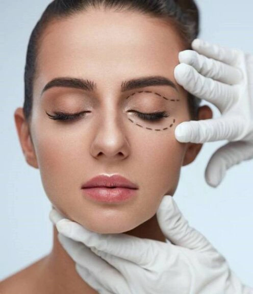 بلفاروپلاستی