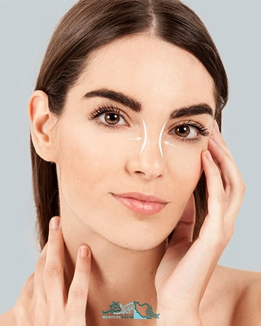 رینوپلاستی در ایران