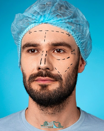 رینوپلاستی در ایران