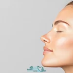 رینوپلاستی