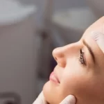 بلفاروپلاستی