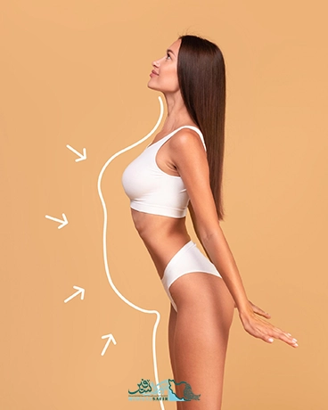 ابدومینوپلاستی در ایران