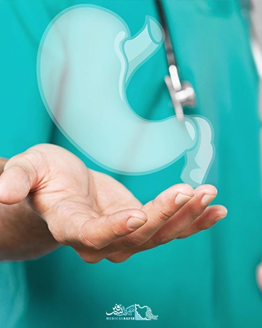 اسلیو معده در ایران