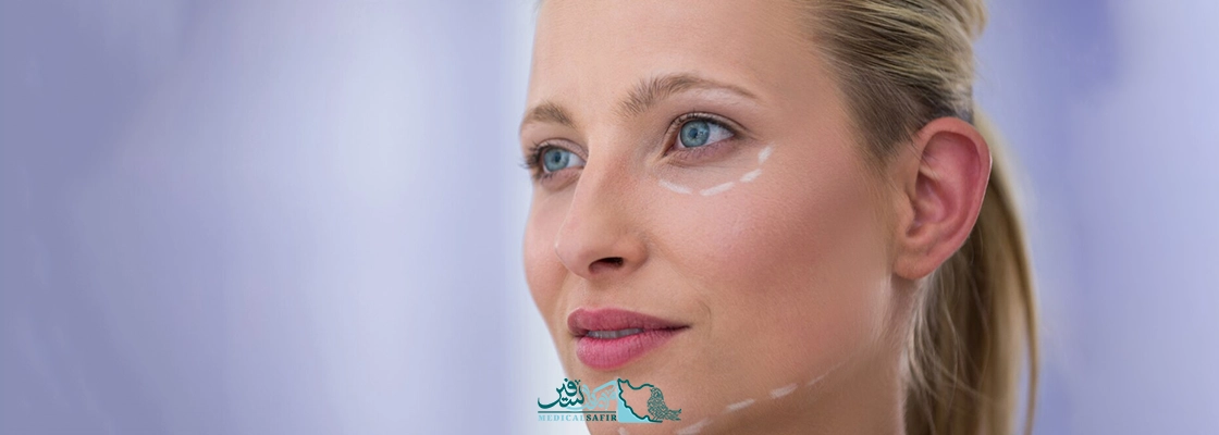 بلفاروپلاستی در ایران