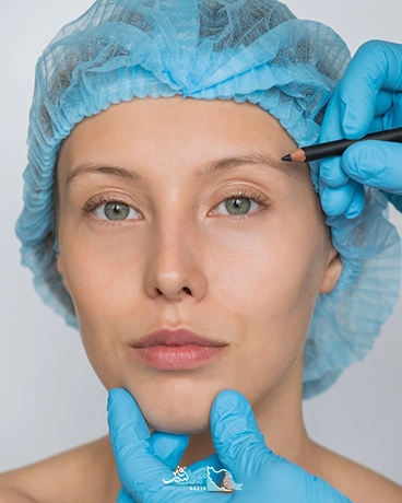 بلفاروپلاستی در ایران