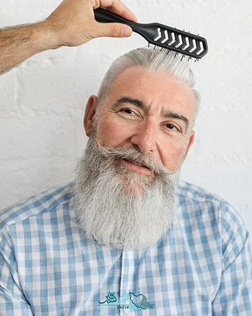 کاشت مو در ایران